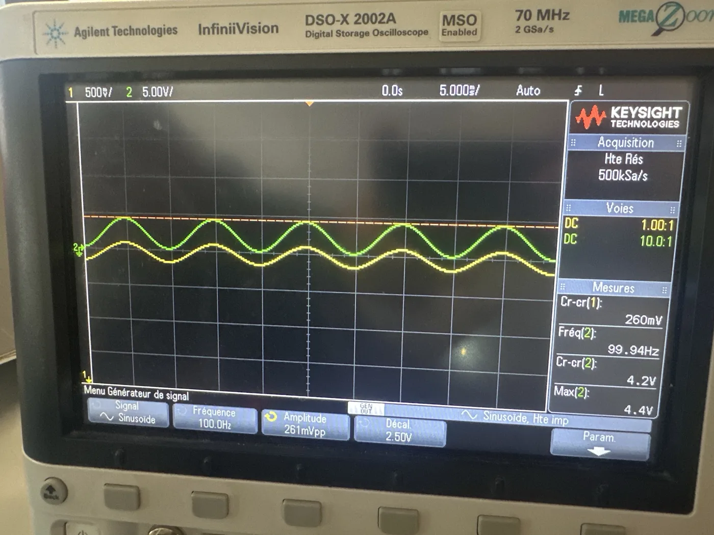 Oscilloscope : signal d'entrée et signal amplifié de l'ECG