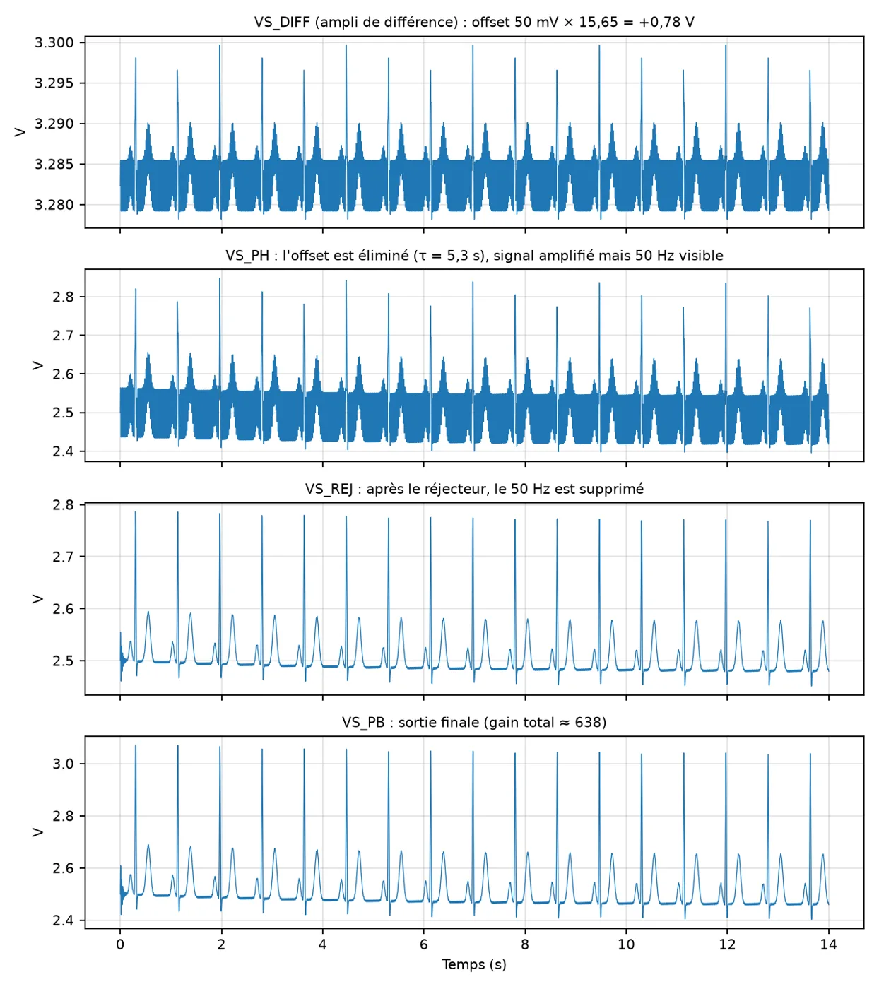 Courbes de simulation de la chaîne ECG à chaque étage